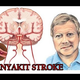 Illustration for article titled Obat Stroke Alami Paling Ampuh